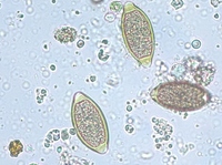 Trichuris2_Makakenaffe